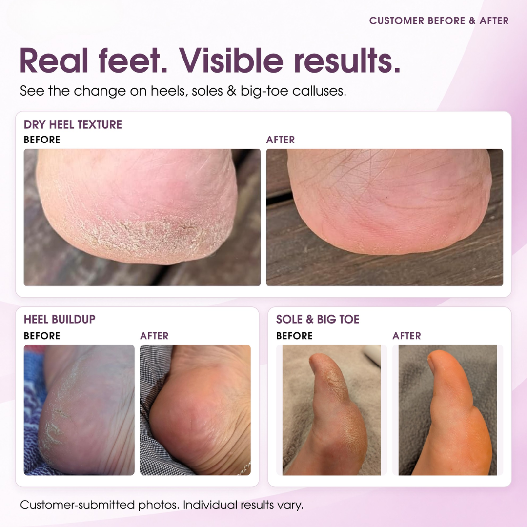 Rylief Magic Foot Pro